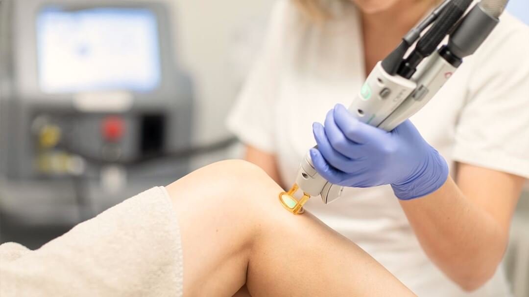 soins medecine esthetique epilation laser centre dermo laser lyon