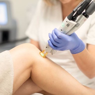 soins medecine esthetique epilation laser centre dermo laser lyon
