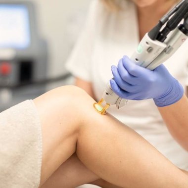 soins medecine esthetique epilation laser centre dermo laser lyon